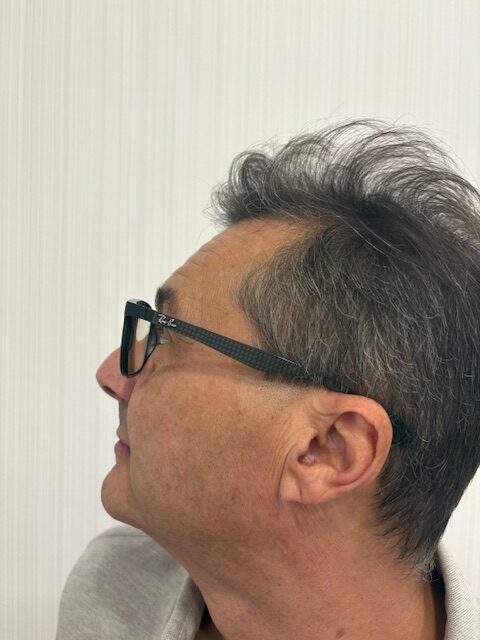 Antes